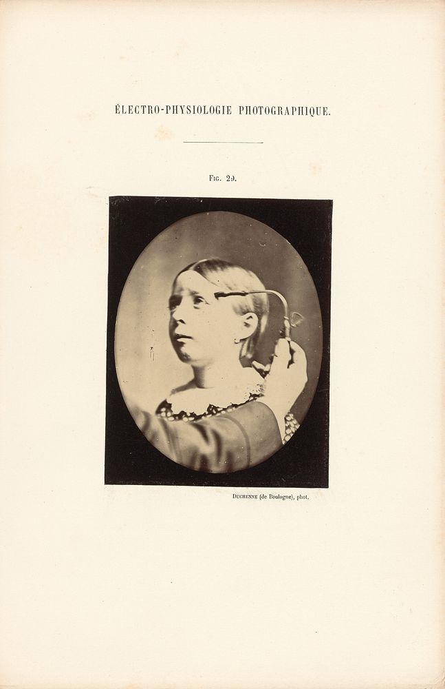 Électro-Physiologie Photographique, Figure 29 by Guillaume Benjamin Duchenne and Adrien Alban Tournachon