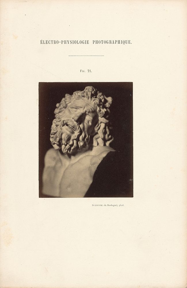 Électro-Physiologie Photographique, Figure 71 by Guillaume Benjamin Duchenne and Adrien Alban Tournachon
