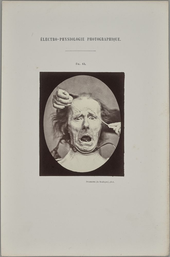 Fig. 64 by Guillaume Benjamin Duchenne and Adrien Alban Tournachon