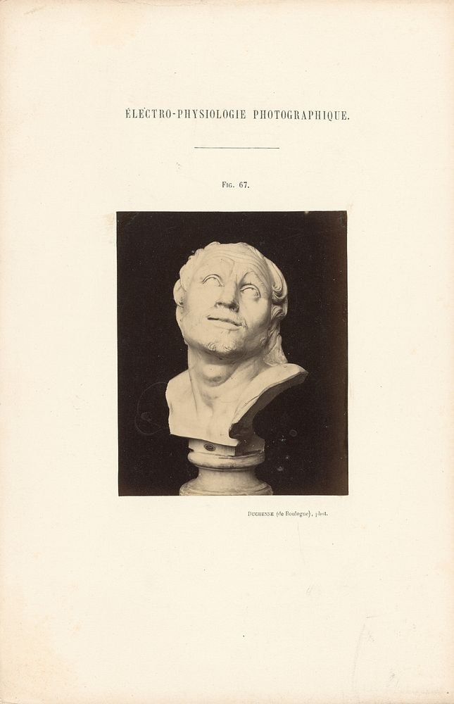 Électro-Physiologie Photographique, Figure 67 by Guillaume Benjamin Duchenne and Adrien Alban Tournachon
