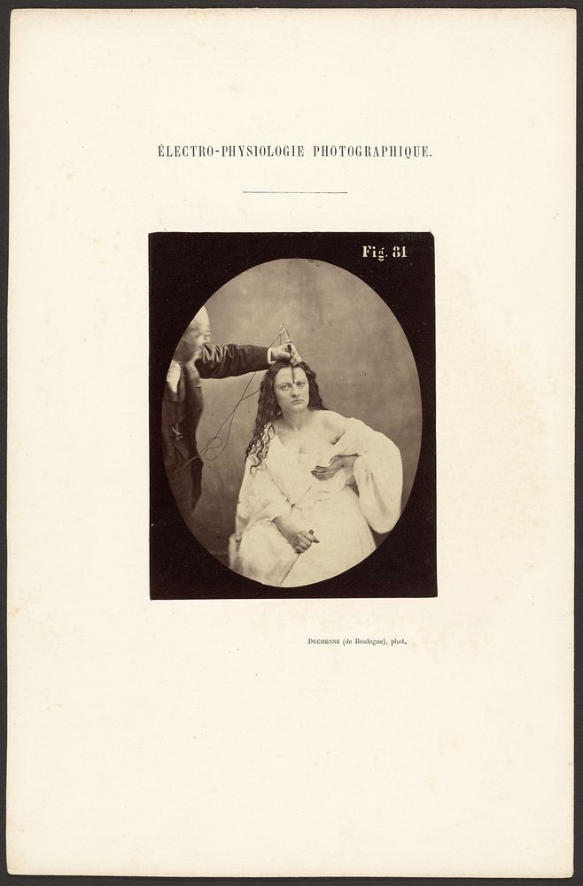 Electro-physiologie Photographique, Fig. 81 by Guillaume Benjamin Duchenne and Adrien Alban Tournachon