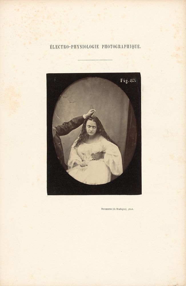 Électro-Physiologie Photographique, Figure 83 by Guillaume Benjamin Duchenne and Adrien Alban Tournachon