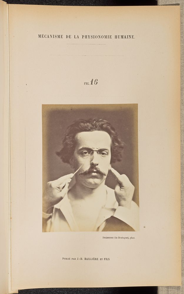 Fig. 16 by Guillaume Benjamin Duchenne and Adrien Alban Tournachon