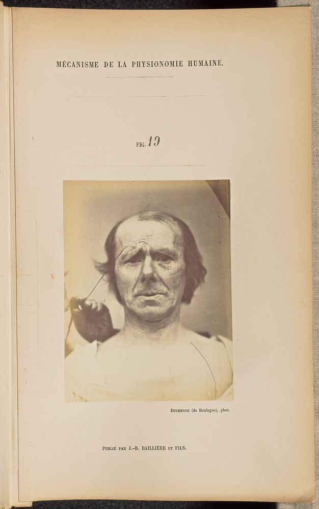 Fig. 19 by Guillaume Benjamin Duchenne and Adrien Alban Tournachon