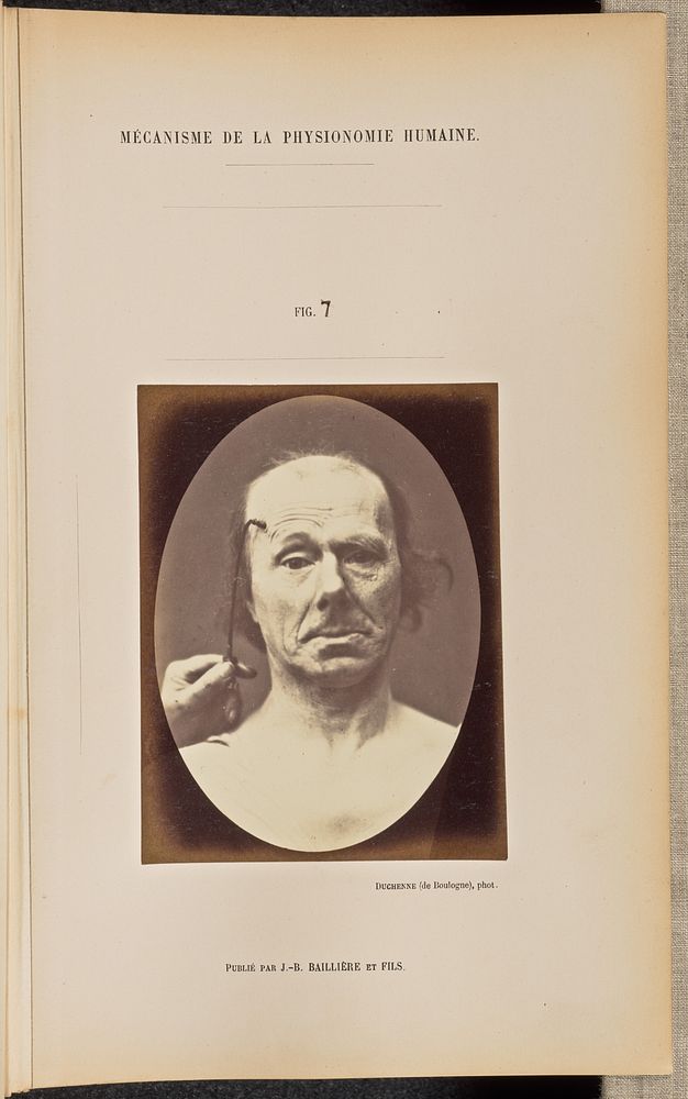 Fig. 7 by Guillaume Benjamin Duchenne and Adrien Alban Tournachon