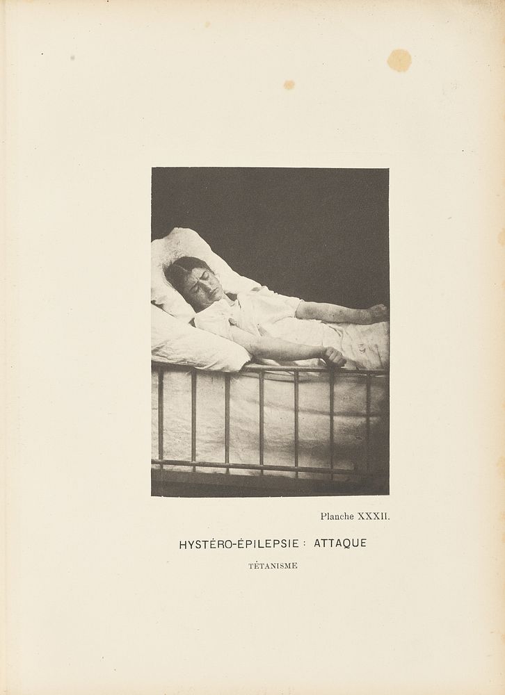 Hystéro-Épilepsie: Attaque Tétanisme by Paul Marie Léon Regnard