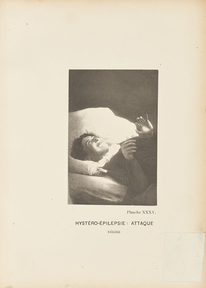 Hystéro-Épilepsie: Attaque Délire by Paul Marie Léon Regnard