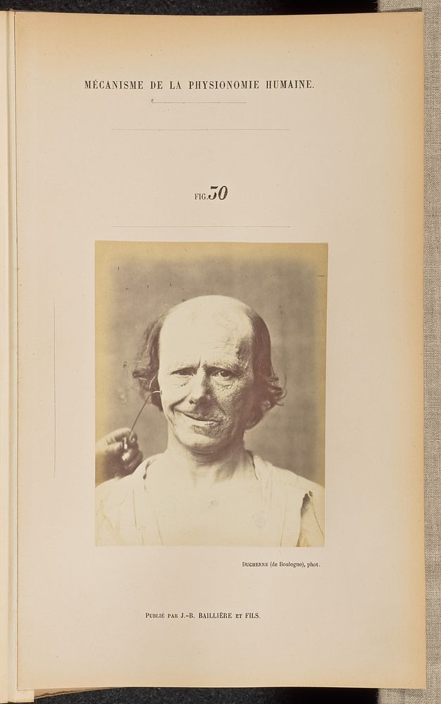 Fig. 30 by Guillaume Benjamin Duchenne and Adrien Alban Tournachon