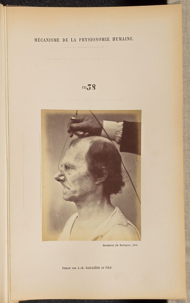 Fig. 38 by Guillaume Benjamin Duchenne and Adrien Alban Tournachon