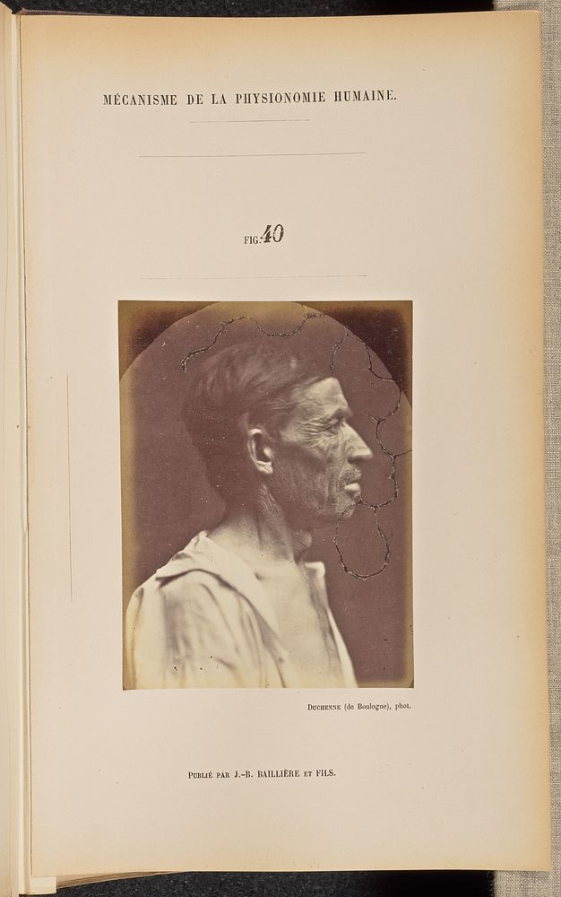 Fig. 40 by Guillaume Benjamin Duchenne and Adrien Alban Tournachon