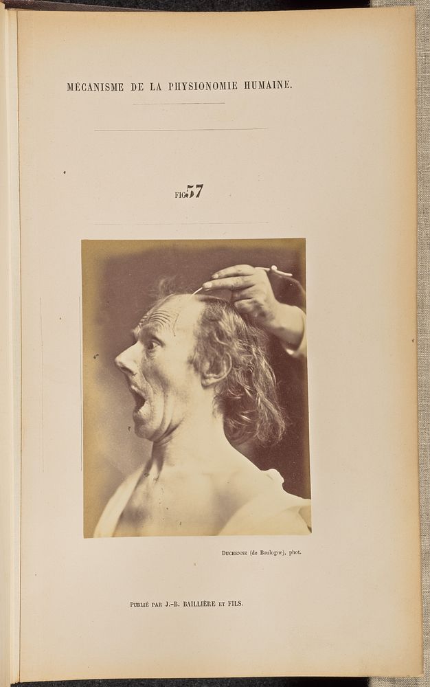 Fig. 57 by Guillaume Benjamin Duchenne and Adrien Alban Tournachon