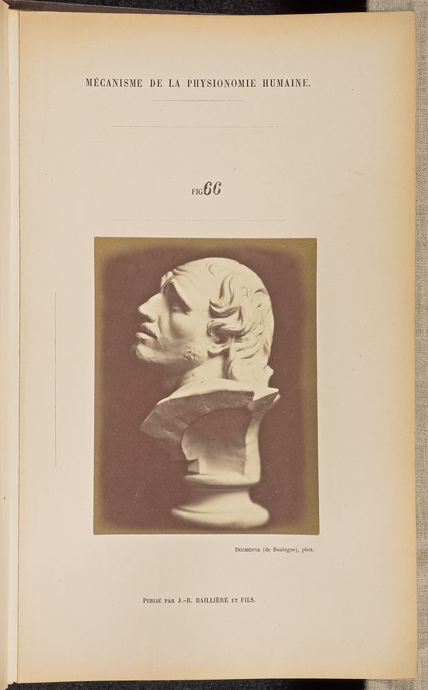 Fig. 66 by Guillaume Benjamin Duchenne and Adrien Alban Tournachon