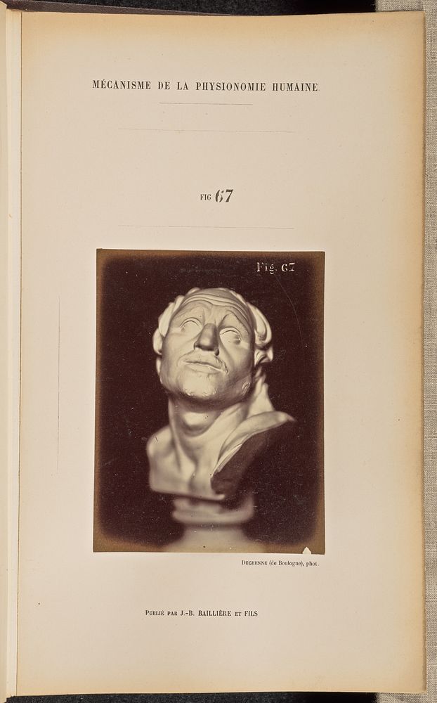 Fig. 67 by Guillaume Benjamin Duchenne and Adrien Alban Tournachon