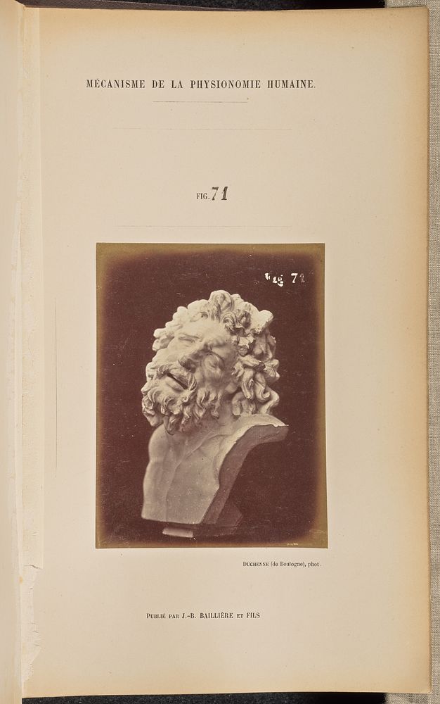 Fig. 71 by Guillaume Benjamin Duchenne and Adrien Alban Tournachon