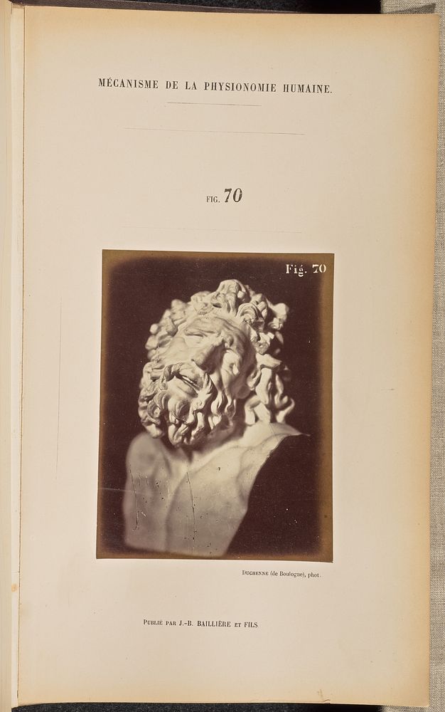 Fig. 70 by Guillaume Benjamin Duchenne and Adrien Alban Tournachon