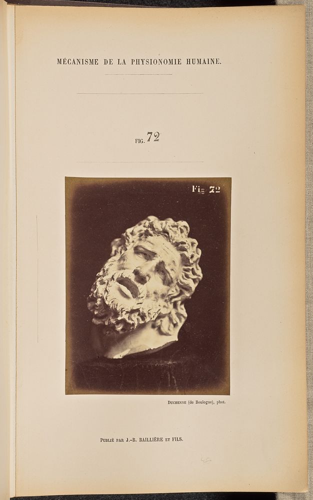 Fig. 72 by Guillaume Benjamin Duchenne and Adrien Alban Tournachon