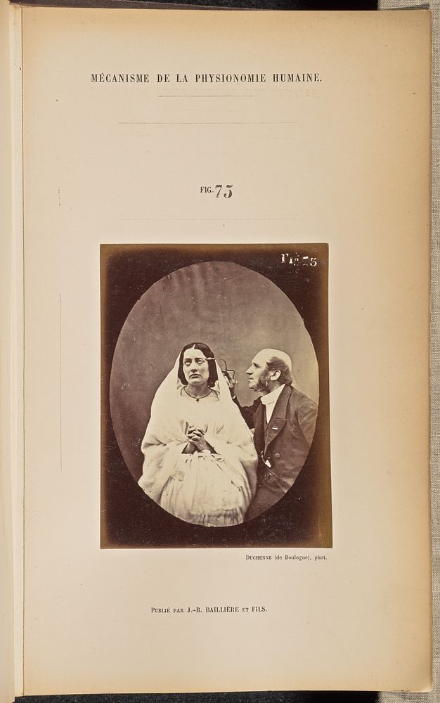 Fig. 75 by Guillaume Benjamin Duchenne and Adrien Alban Tournachon