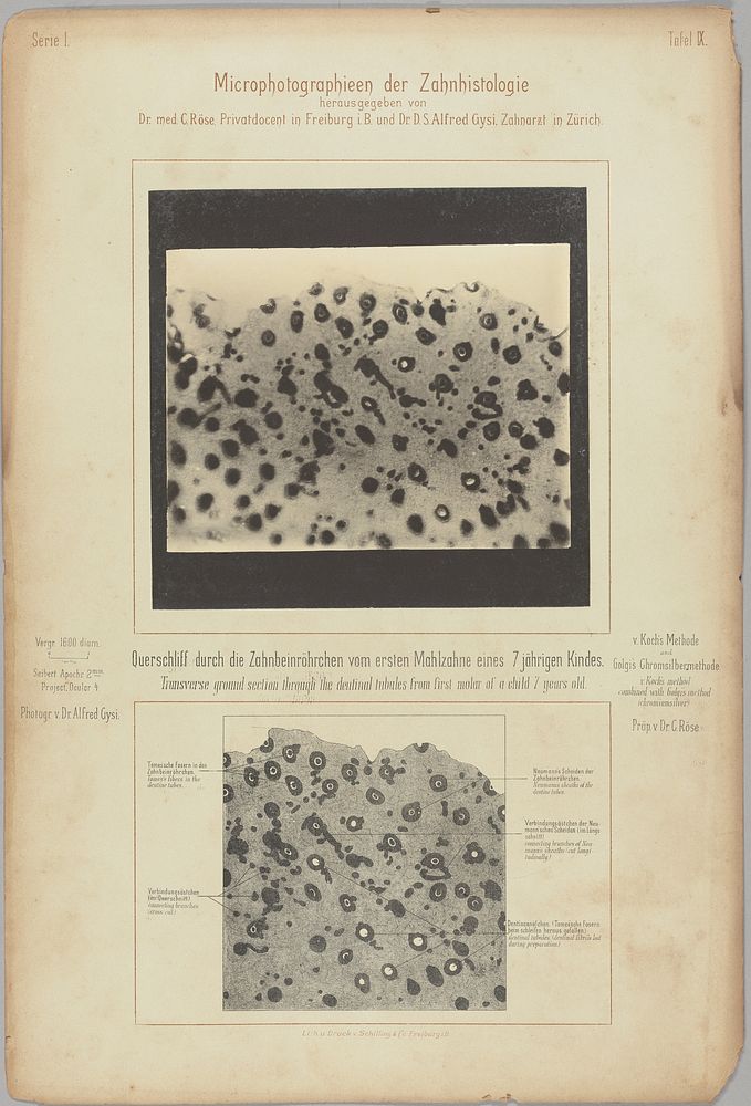 Dentinal tubules. Transverse ground section by Dr Alfred Gysi