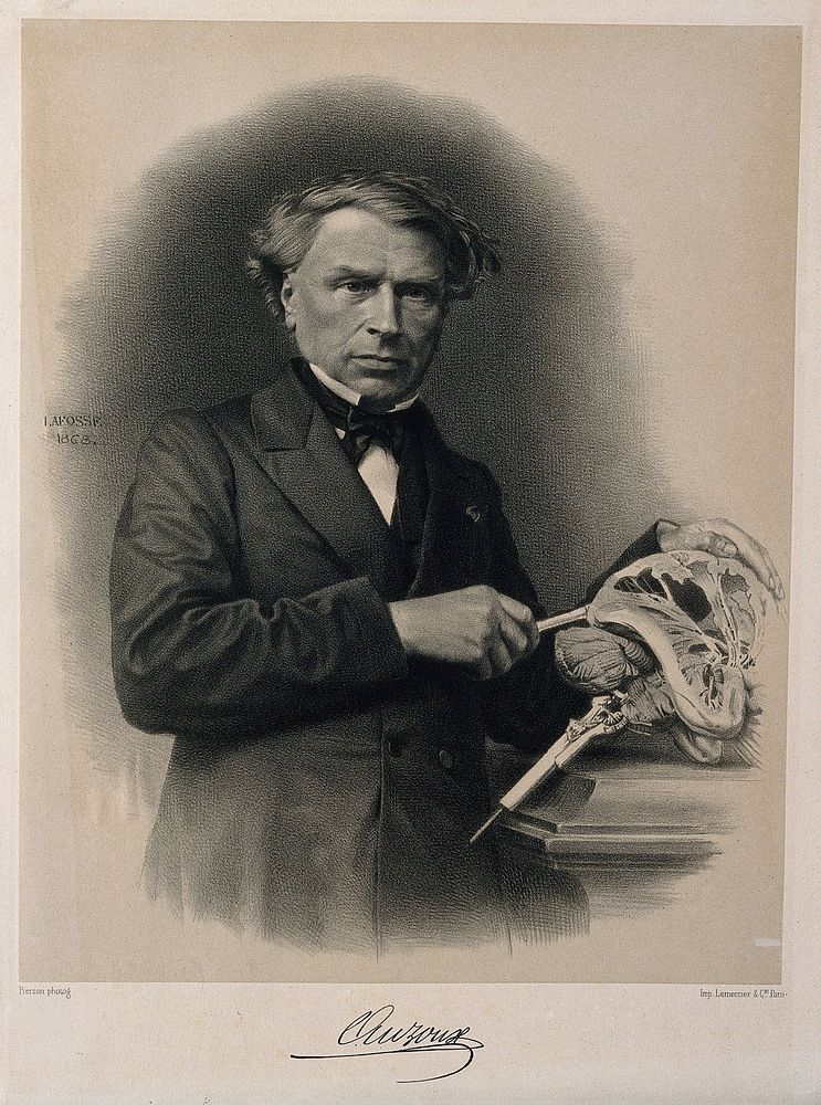 Thomas Louis Jérome Auzoux. Lithograph by J.B.A. Lafosse, 1868, after Pierson.