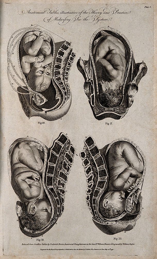 Four diagrams of babies in the womb. Engraving by W. Taylor, 1791, after F. Birnie after W. Smellie.