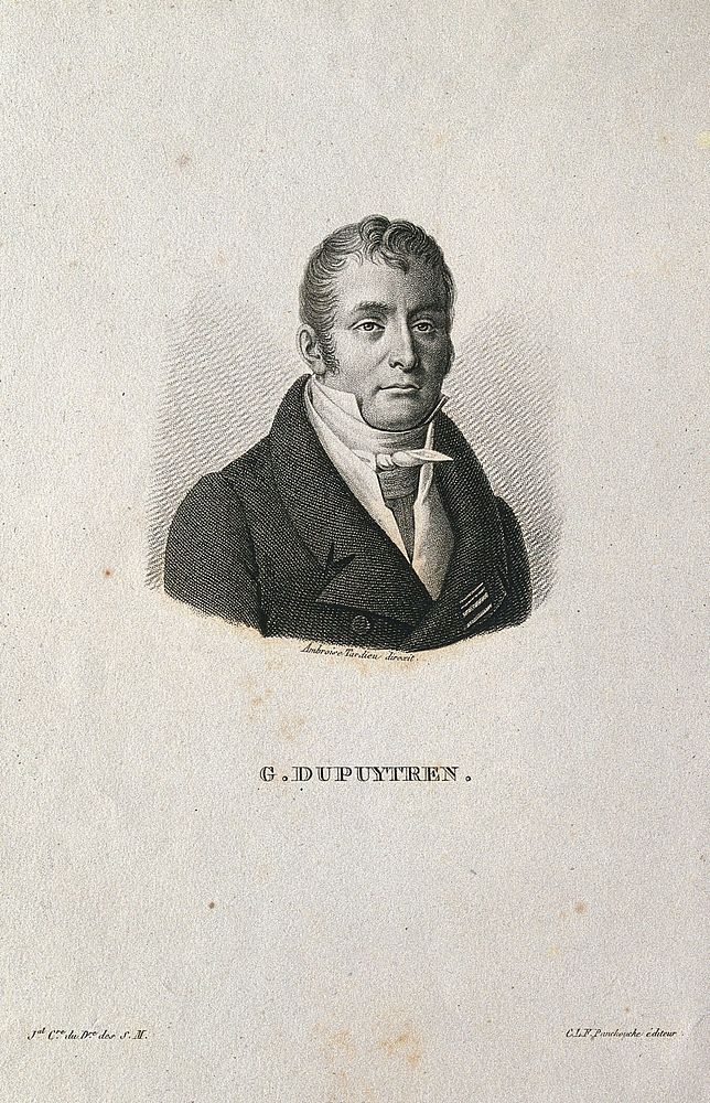 Guillaume, Baron Dupuytren. Stipple engraving by A. Tardieu.
