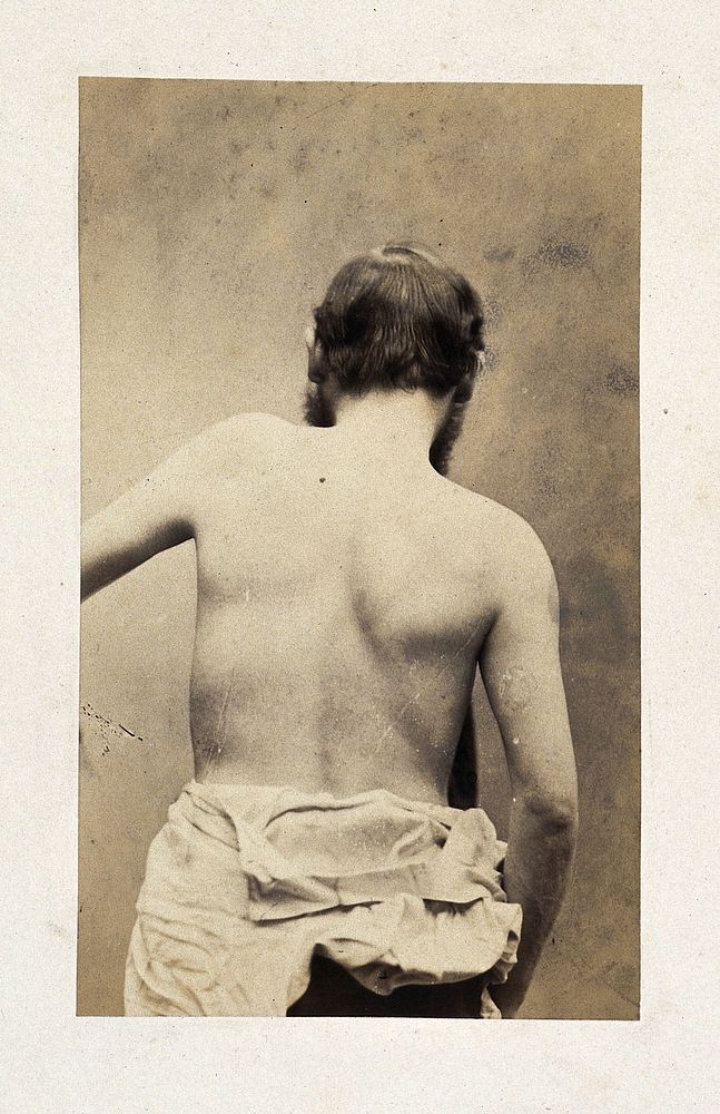 A bearded man, unclothed to his waist and viewed from behind; his left arm slightly raised. Photograph by L. Haase after…