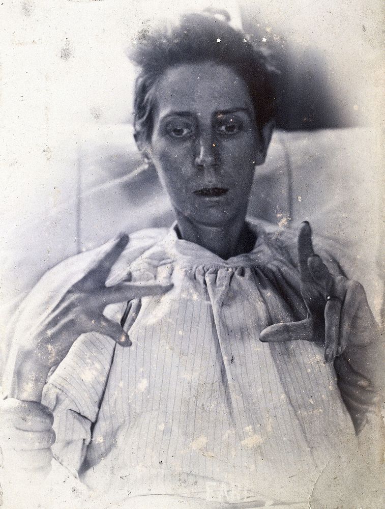 Friern Hospital, London: a woman suffering from mania, with forearm, hand and finger movements. Photograph, 1890/1910.
