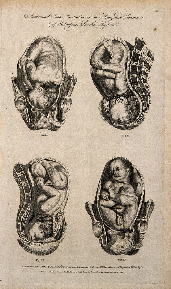 Foetuses in utero: four figures showing cross-sections of a foetus in various positions in the uterus. Line engraving, 1791…