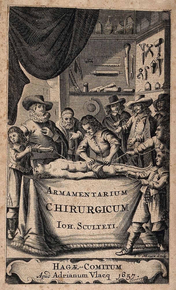 A surgeon setting a leg with the aid of three assistants, observed by onlookers, in front of walls on which various surgical…