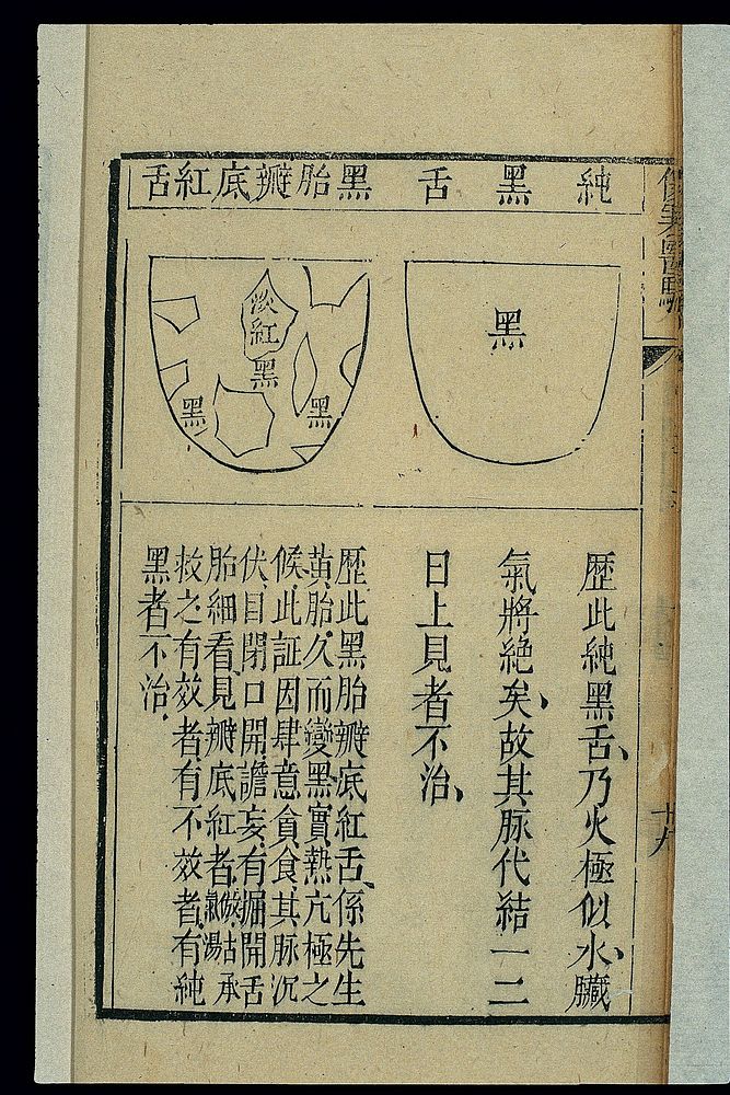 Tongue morphology: Heitai biandi hongshe, Chinese woodcut