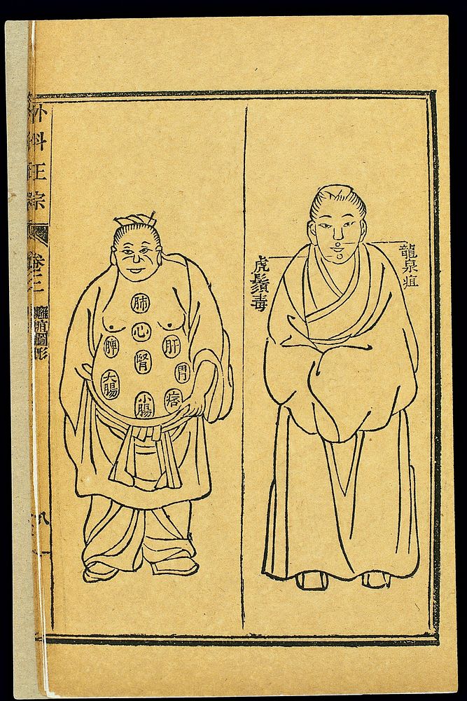 Chinese woodcut: Various abscesses and tumours