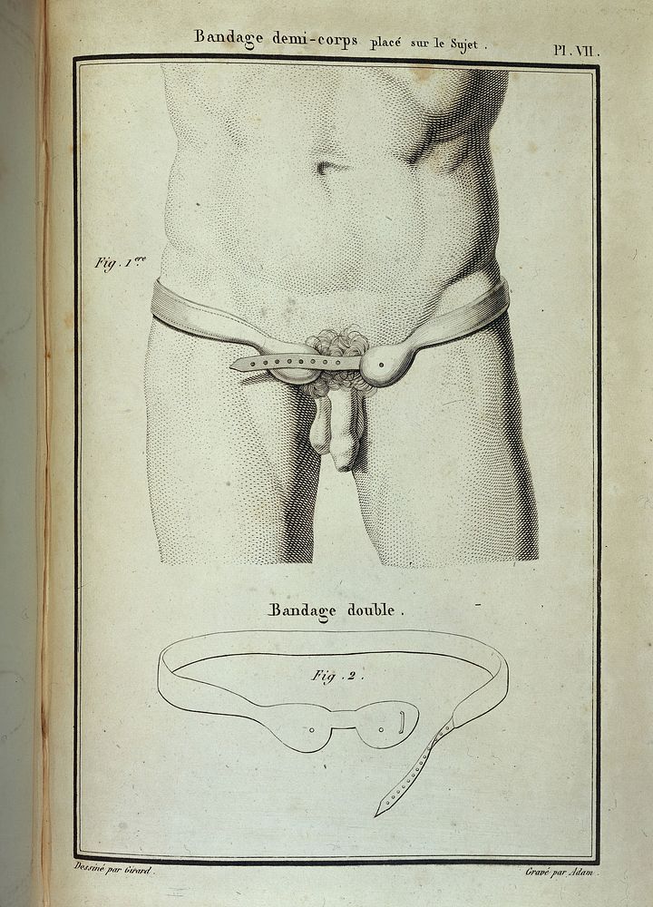 Diagram of a Hernia bandage on male subject