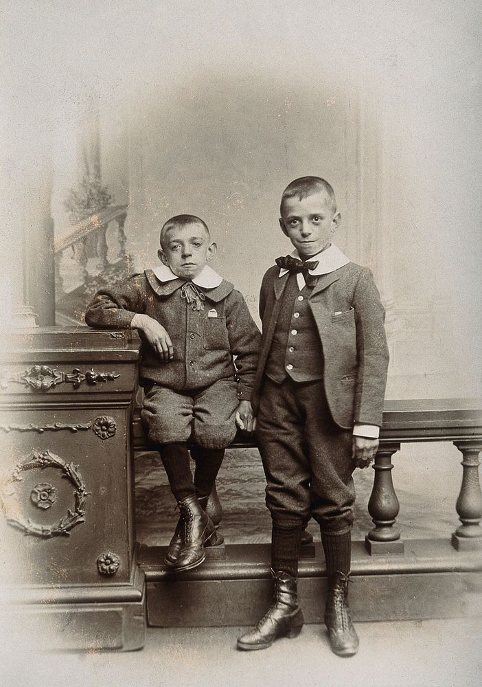 Two boys, one sitting and one standing: the former appears physically deformed. Photograph, 1899.