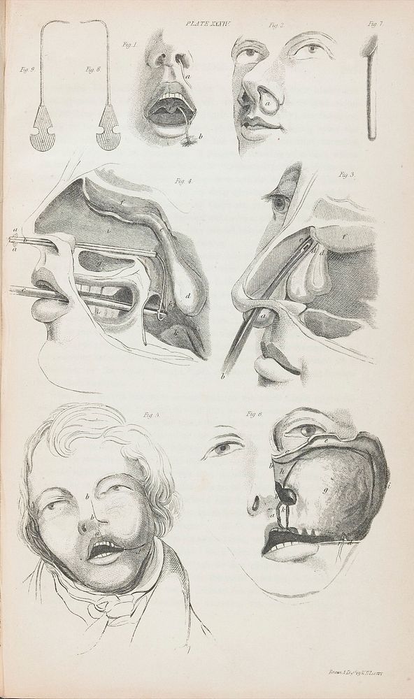 A system of practical surgery, including all the recent discoveries and operations / [John Lizars].