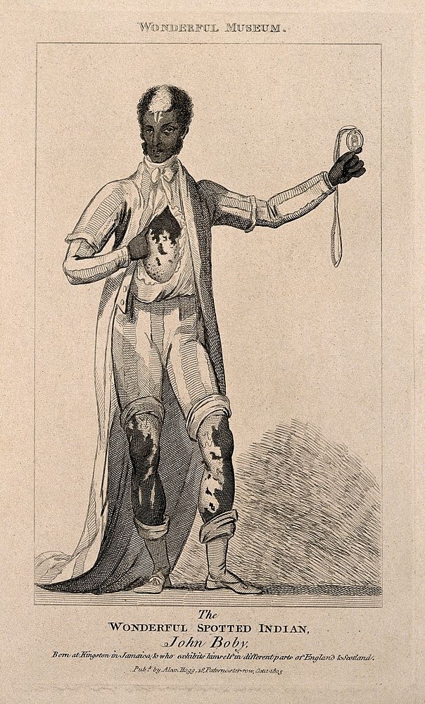 John Boby, a black man with white markings. Reproduction of an etching, 1803.