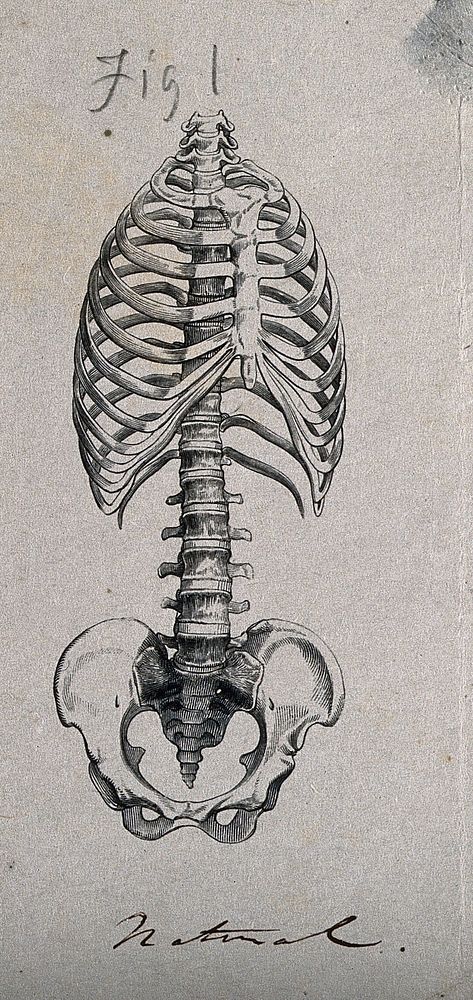 Bones of the ribcage and pelvis: two figures, showing the appearance of the ribcage and spine in both its natural state, and…
