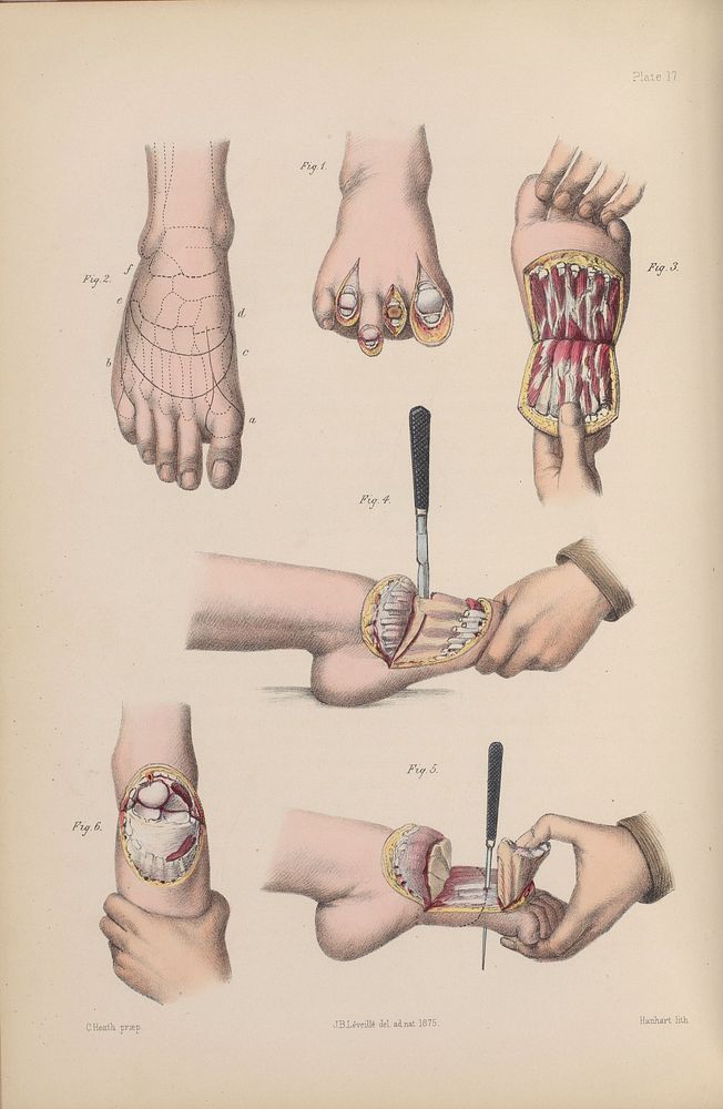 A course of operative surgery / with plates drawn from nature by M. Léveillé and coloured by hand under his direction ; by…