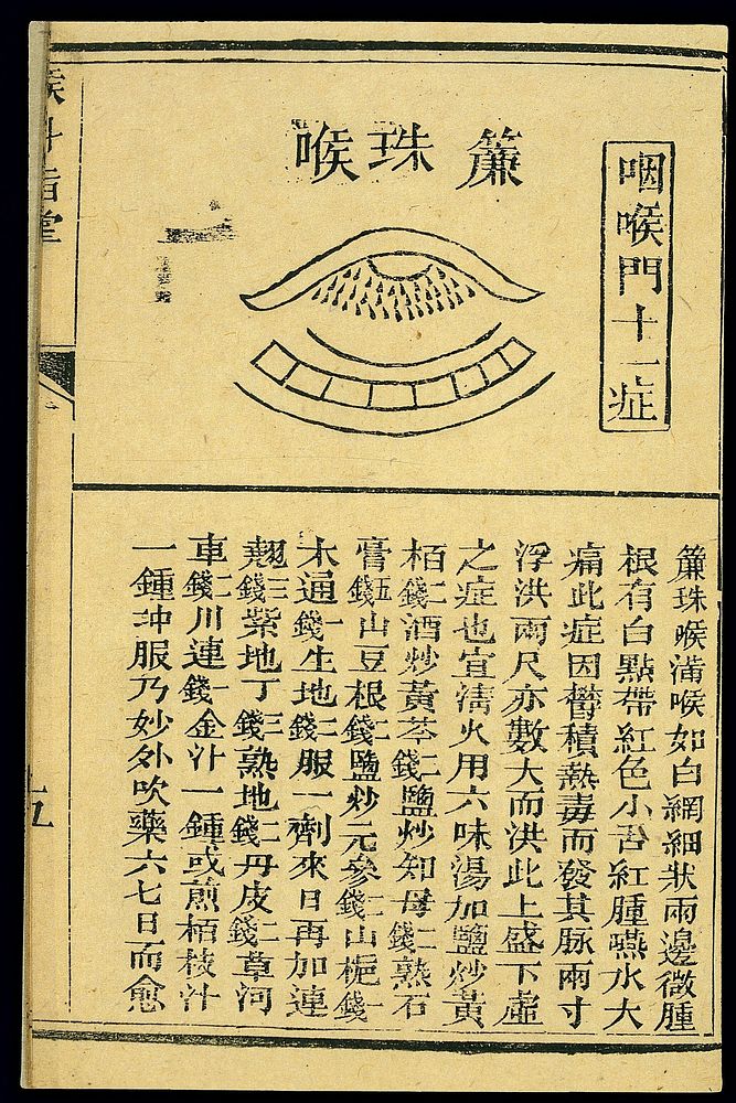 Chinese C19 woodcut: Throat conditions