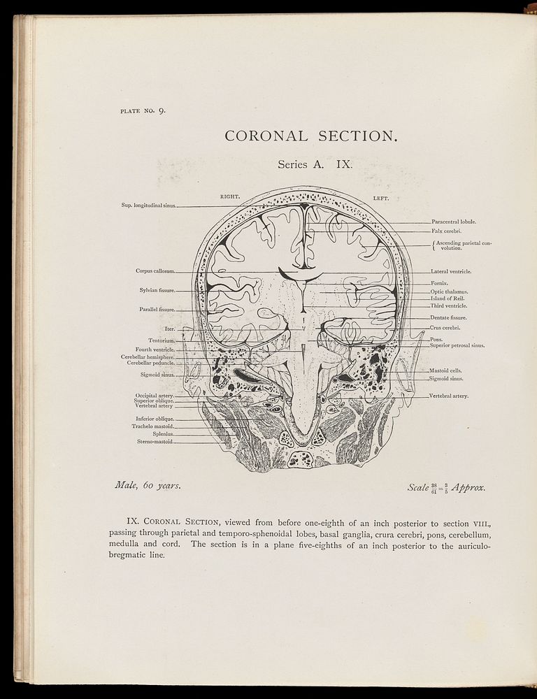 Atlas of head sections : fifty-three engraved copperplates of frozen sections of the head and fifty-three key plates with…