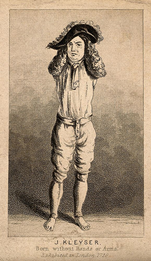 Johann Kleyser, a man born without arms. Aquatint.