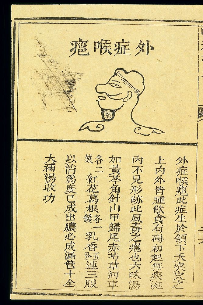 Chinese C19 woodcut: 'Throat Wind' conditions