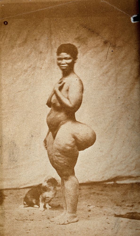 A standing woman, full-length side view, with enlargement of the buttocks (steatopygia). Photograph.