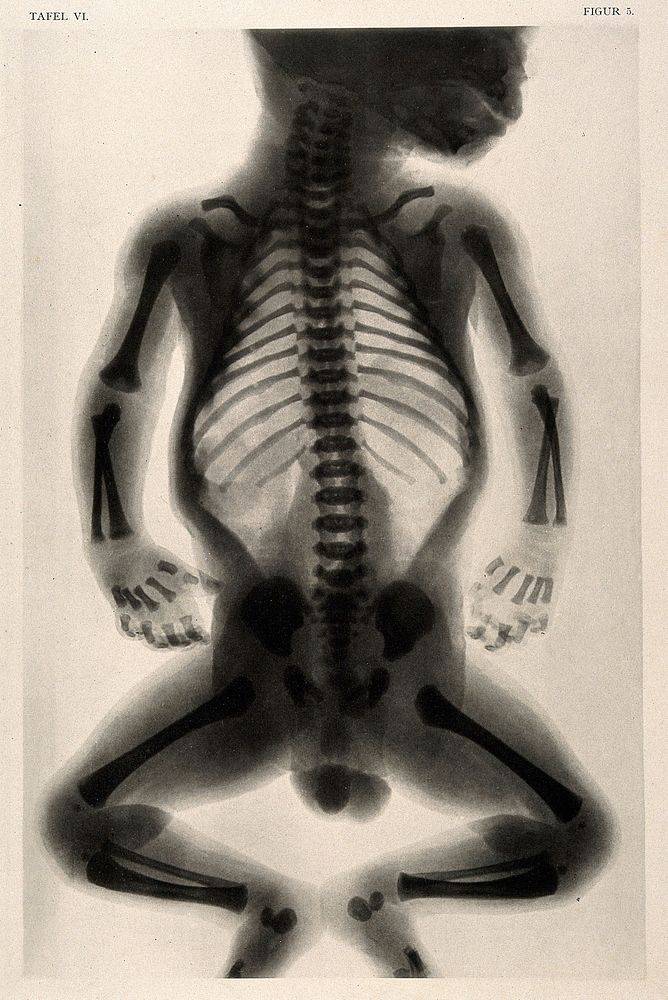 Skeleton of a mature child. Collotype by Römmler & Jonas after a radiograph made for G. Leopold and Th. Leisewitz, 1908.