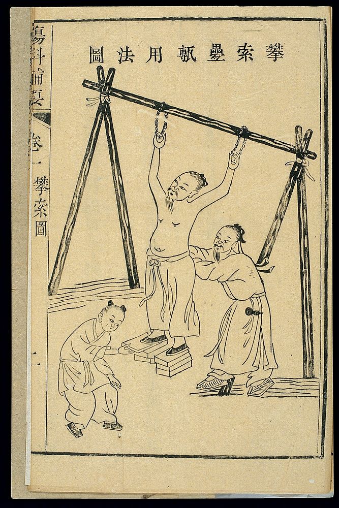 Chinese woodcut: Orthopedic technique to treat prolapsed disk