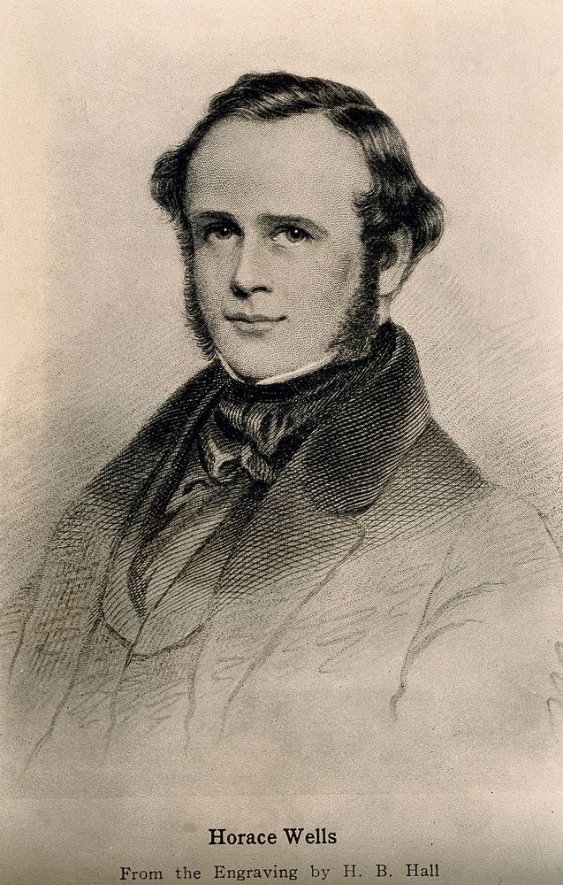 Horace Wells. Photograph of reproduction of stipple engraving by H. B. Hall.