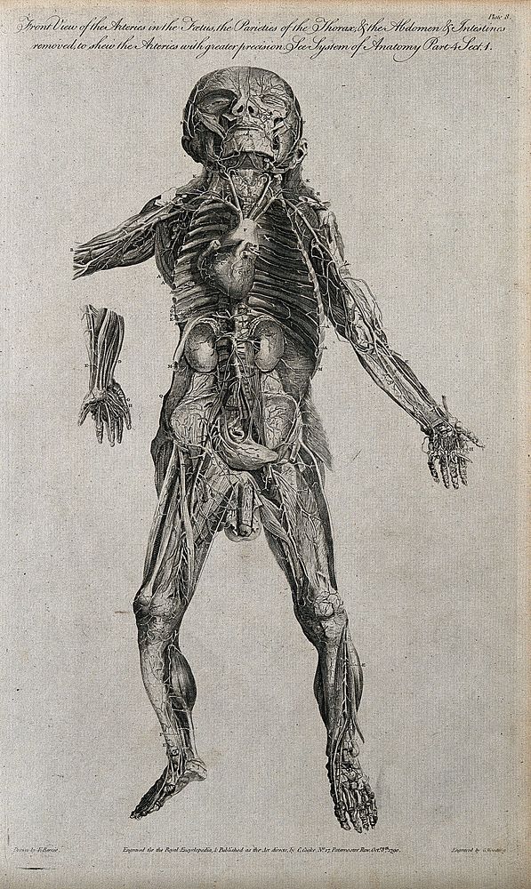 Dissected foetus seen from the front, with arteries indicated. Line engraving, by G. Wooding after F. Birnie, 1790.
