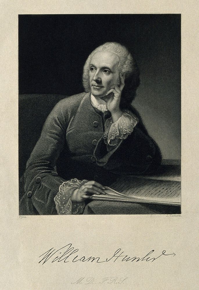 William Hunter. Stipple engraving by J. Thomson, 1847, after R. E. Pine.