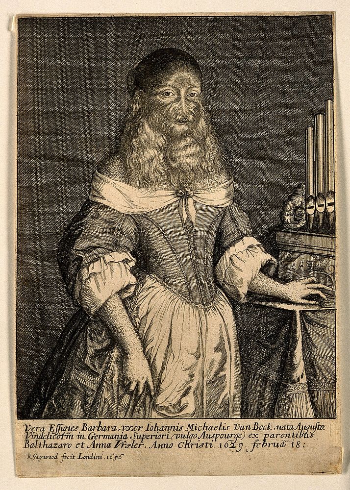 Barbara van Beck, a hirsute woman. Etching by R. Gaywood, 1656.