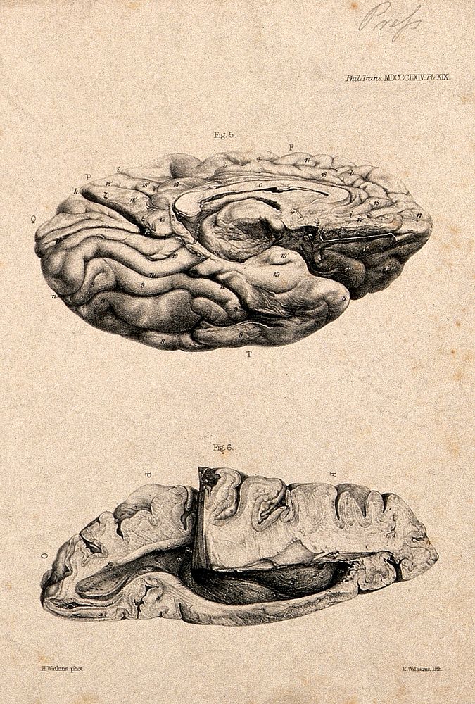 Brain of an African Bushwoman: two figures, each of a section of the brain. Lithograph by E.M. Williams after H. Watkins…