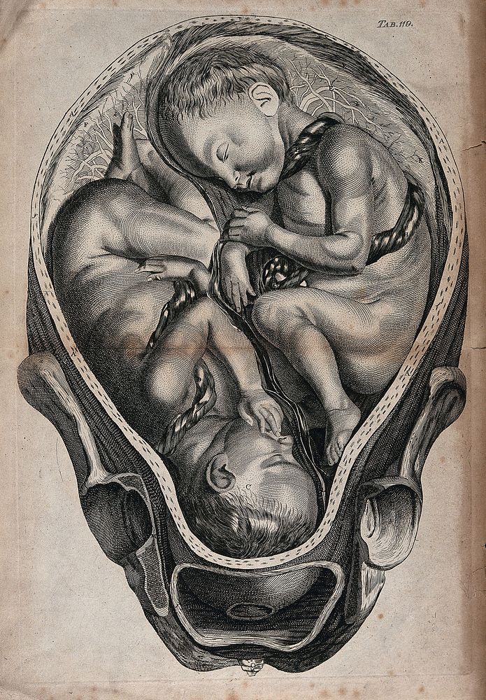 A cross-section of a pregnant uterus containing twins. Engraving after W. Smellie after J. van Rymsdyck.
